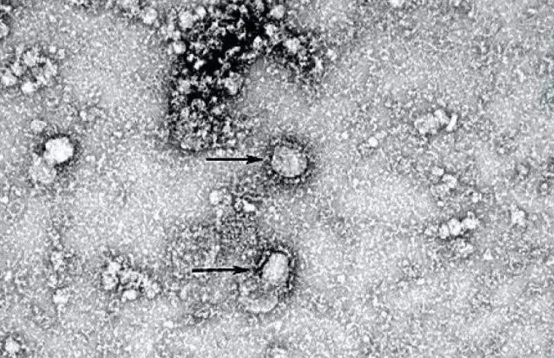 A aparição no Reino Unido de uma mutação do coronavírus, muito mais infecciosa que as outras, já estava circulando no Brasil desde o início da pandemia